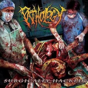 pathology-surgically-hacked